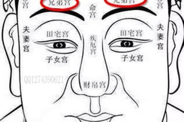 额头胎记算命图解