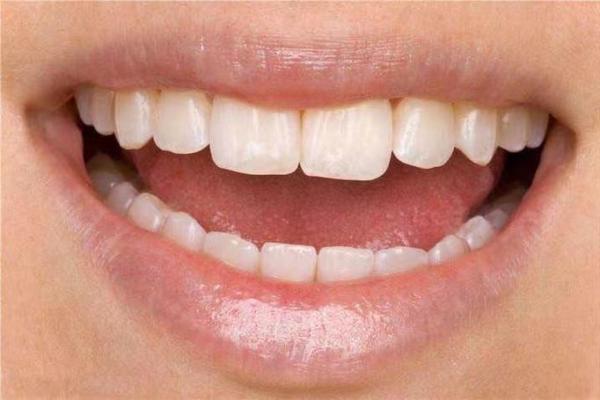 牙齿算命:牙齿的颜色看你的运势 牙齿算命:牙齿的颜色看你的运势