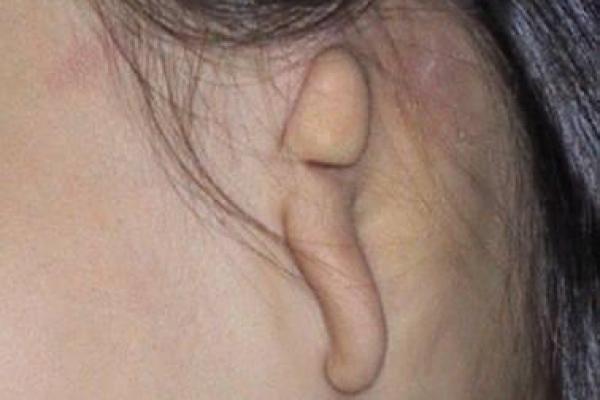 风水天生耳朵小的人运势 风水天生耳朵小的人运势