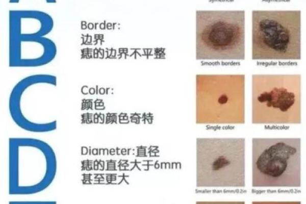 身体上的胎记位置不同算命分析