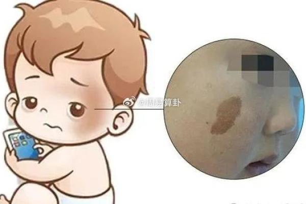 胎记算命的方法 胎记算命的方法